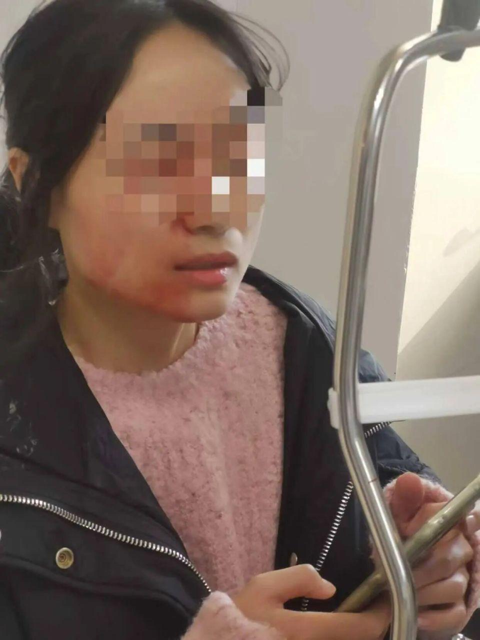 教师劝架被学生用镊子戳伤眼球，学生未成年免予行政处罚，低龄免责是否该有例外？如何保障教师校内安全？