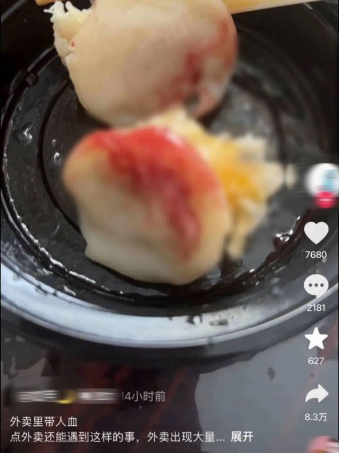 外卖吃出大量血迹，店员承认伤口却拒做传染筛查，消费者自服阻断药，后厨带伤操作，可能会有哪些风险？